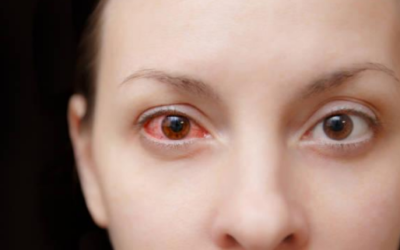 Causes and Treatments of Pink Eye